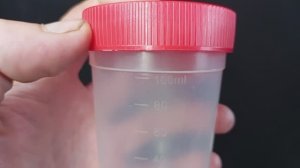 Баночка, ëмкость для анализов мочи