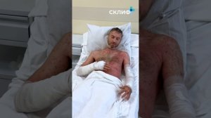 Грядки смерти открыты первая жертва борщевика в этом сезоне — ожоги по всему телу, пострадало 80% ко