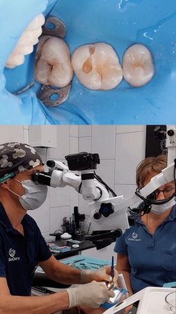Современная стоматология: восстановление без боли #shortvideo #dentist #доктор #стоматология