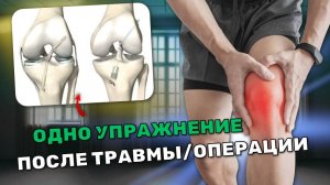 Полное разгибание для коленного сустава. ЛФК и реабилитация после операции и не только.