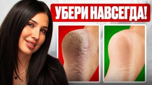 Как убрать трещины на пятках