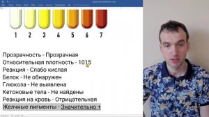 Общий анализ мочи (ОАМ) - желтуха 2. Консультация к экзамену.