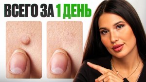Я нашла новое средство от папиллом