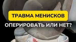 ТРАВМА МЕНИСКОВ — оперировать или нет?