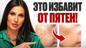 Рецепт от пигментных пятен
