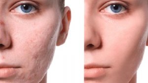 Как касторовое масло придает сияние и омолаживает кож