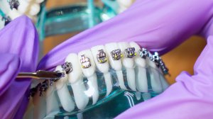 Презентационный ролик - СТОММАКС