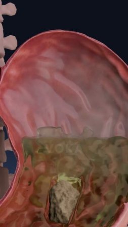 Визуализация вздутия живота в 3D: что происходит в вашем теле?
