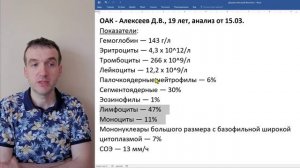 Общий анализ крови (ОАК) - инфекционный мононуклеоз.