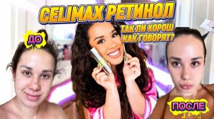 CELIMAX РЕТИНОЛ: ДО И ПОСЛЕ..Так ли он хорош как говорят?🔥🤯