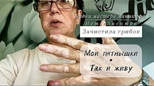 #vlog/Будни с мастером маникюра/Зачистила грибок ногтей 🍄