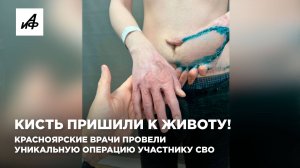 Кисть пришили к животу! Красноярские врачи провели уникальную операцию участнику СВО