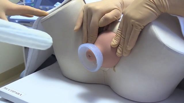 Акушерский пессарий Dr. Arabin (Доктор арабин). смотреть онлайн