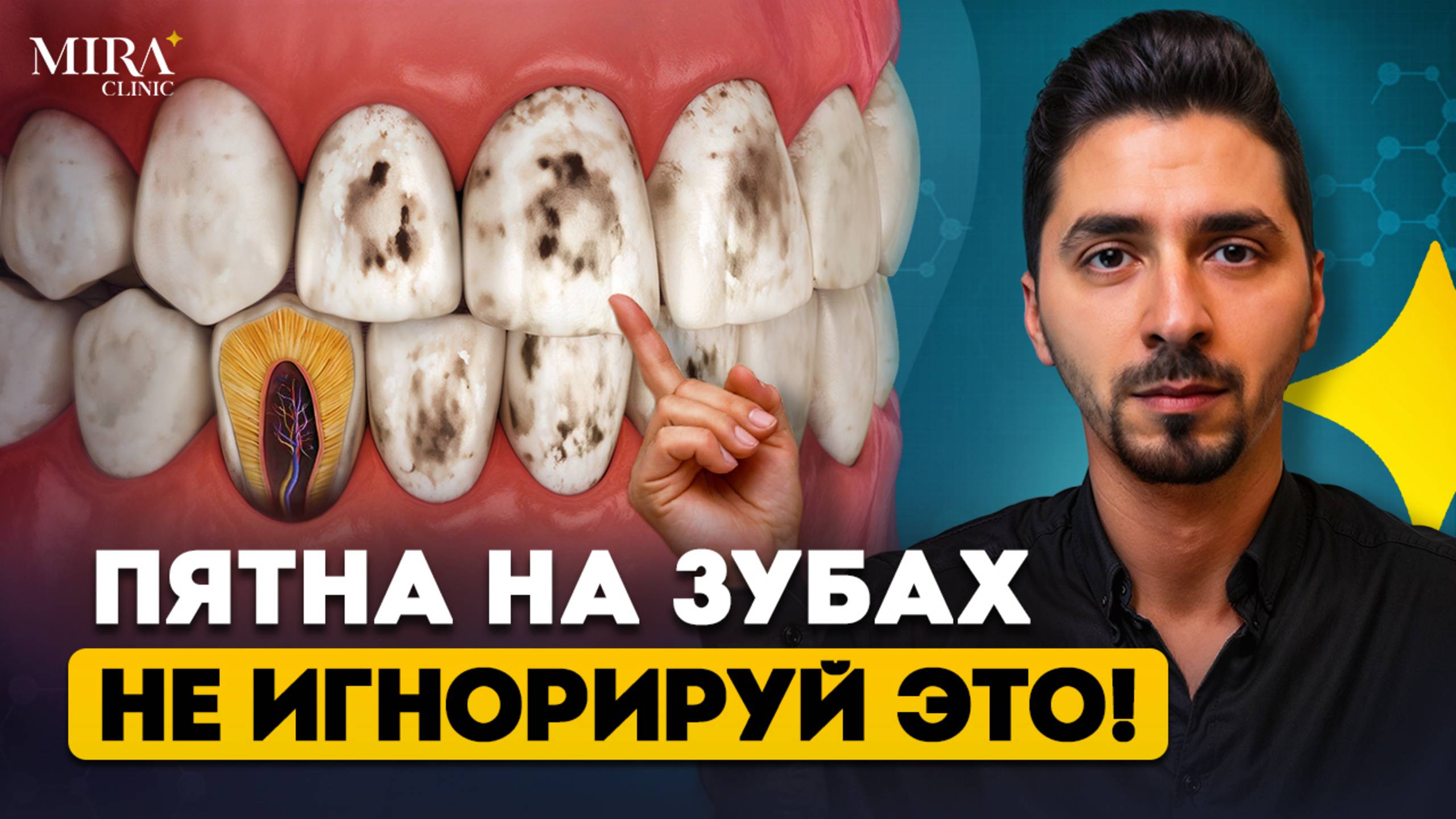 Пятно на зубе — НЕ всегда КАРИЕС! Узнай, в чём разница