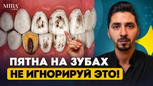 Пятно на зубе — НЕ всегда КАРИЕС! Узнай, в чём разница