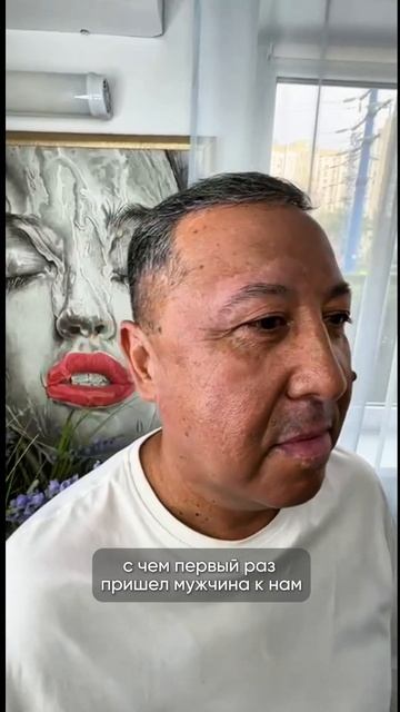 Убрали витилиго на лице | Запишись по номеру +7(926)762-61-07 смотреть онлайн
