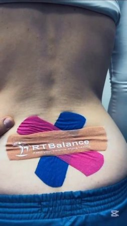 тейпирование при локальной боли в пояснице #RTBalance #АВАР #Лауста @lausta @rehabilitationavar