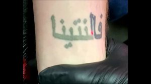 Лазерное удаление татуировки в Брянске