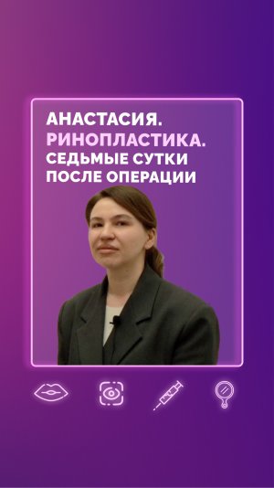 Анастасия. Ринопластика. 7 сутки после операции