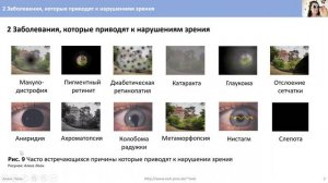 2 Заболевания, которые приводят к  нарушениям зрения