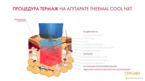 Thermage (термаж) перевернул наши представления о современных методах омоложения