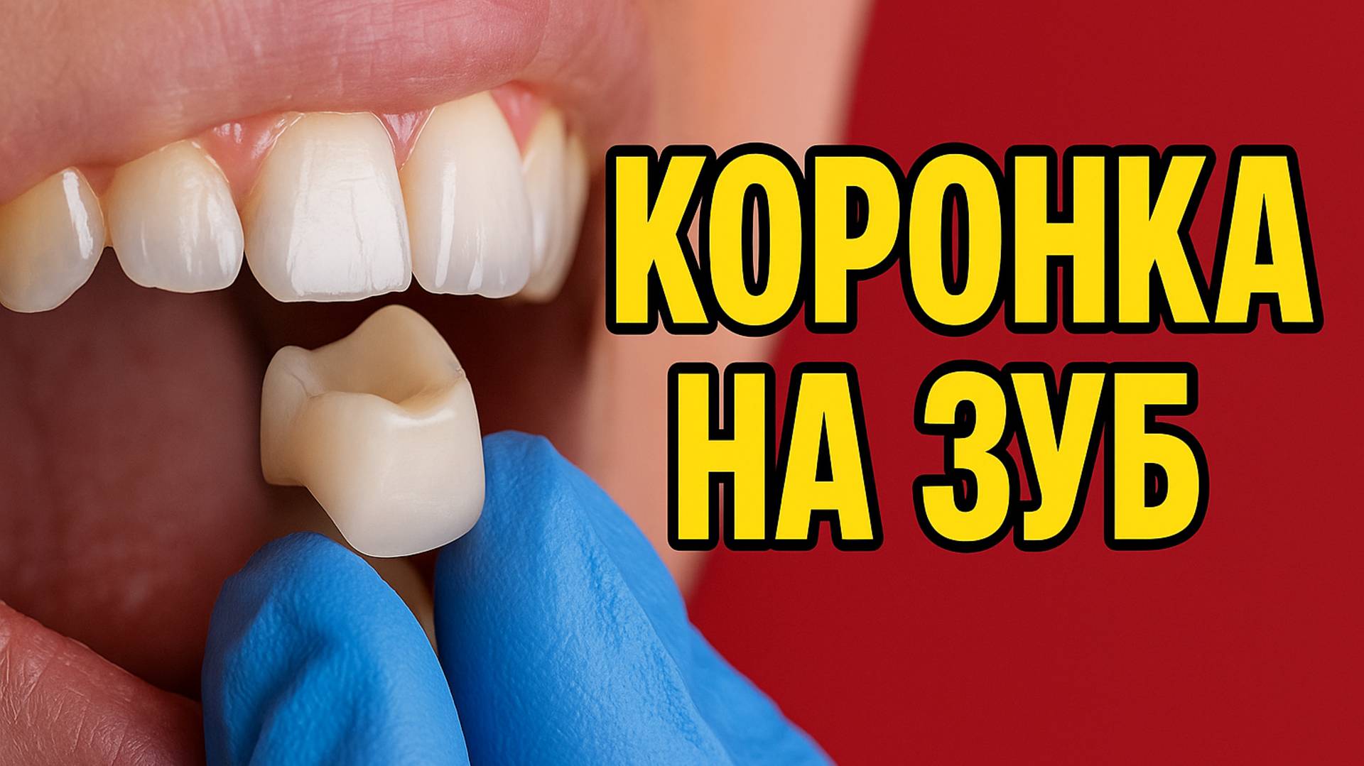 Коронка на зуб. Изготовление и фиксация коронки в одно посещение