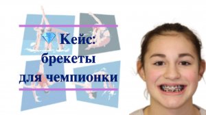 💎 Кейс: брекеты для чемпионки