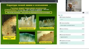 Как почистить тонкий кишечник? Здоровье и питание тон?