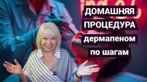 Домашний уход: процедура с аппаратом Дермапен. Мои впечатления и советы