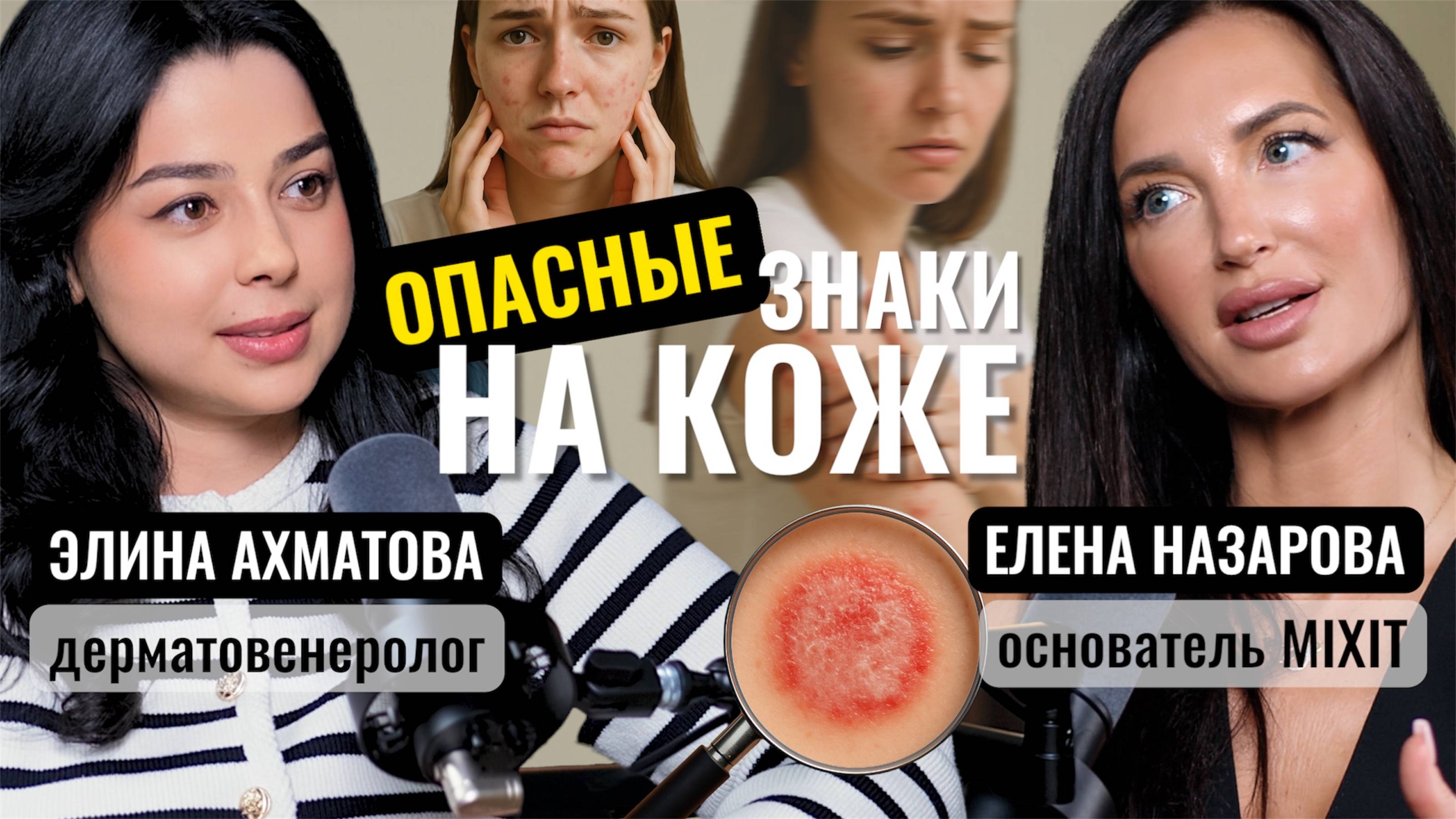 Что скрывает твоя кожа? Опасные родинки, вирусы и болезни — разбор с дерматологом.