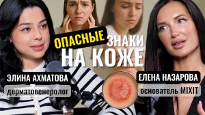 Что скрывает твоя кожа? Опасные родинки, вирусы и болезни — разбор с дерматологом.