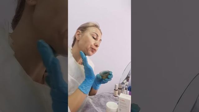 Делаю ферруловый пилинг