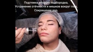 Рф-лифтинг лица