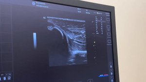 КУРС РЕГИОНАРНАЯ АНЕСТЕЗИЯ