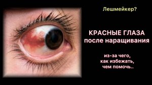 Из-за чего? Как избежать? Как исправить?