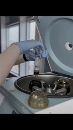 PRP-терапия — ваш союзник в эффективной пересадке волос 💉