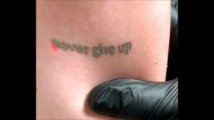 Осветление тату под перекрытие