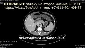 УДЛИНЕНИЕ кишечника, ДОЛИХОКОЛОН и дополнительные ПЕ?