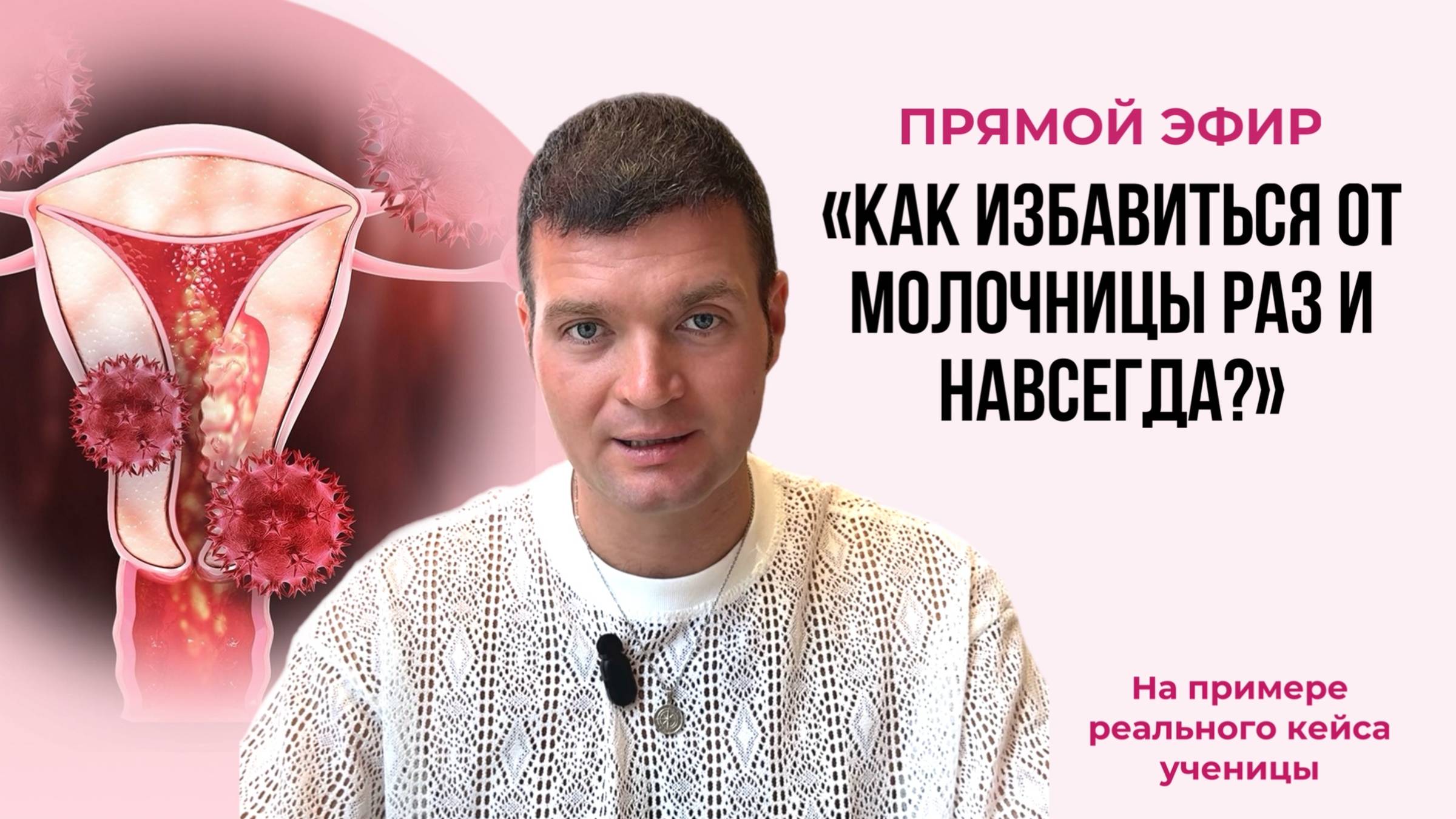 Прямой эфир "Молочница каждый месяц? Смотри, что на самом деле за этим стоит."