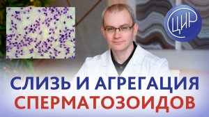 Слизь и агрегация сперматозоидов - что это значит? Спермограмма. Расшифровка спермограммы.