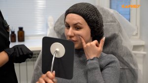 «Атлас красоты»: индивидуальная гармонизация лица. Векторный нитевой лифтинг без реабилитации