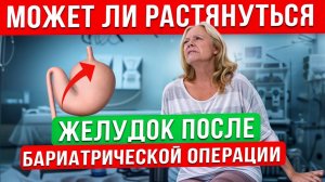 Может ли растянуться желудок после бариатрической операции?