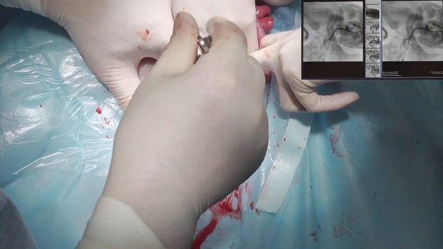 Шунт у собаки портоазигональный смотреть онлайн