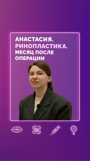 Анастасия. Ринопластика. Месяц после операции