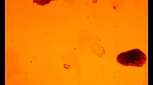 Ведро микробов