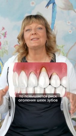 Почему наклон зубов влияет на здоровье десен #еленавитальевнатерентьева #десна