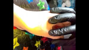 Удаление татуировки в Брянске