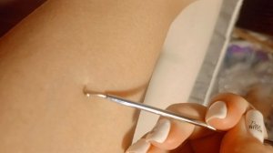 Вросшие волосы ASMR