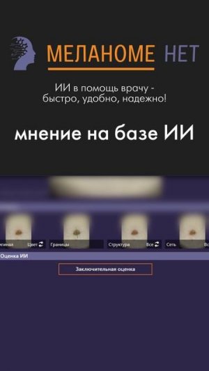 ИИ в помощь врачу — быстро, надёжно, удобно