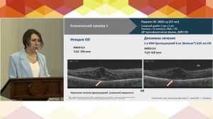 3. СЕССИЯ «АКТУАЛЬНЫЕ ВОПРОСЫ ОФТАЛЬМОЛОГИИ НА СОВРЕМЕННОМ ЭТАПЕ»